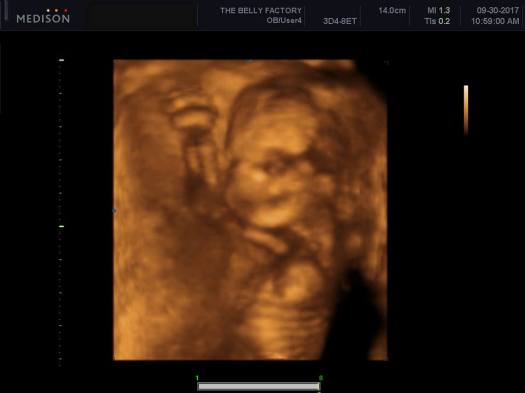 22050074_10156808273678677_8858332974756447897_n